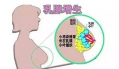 有乳腺囊性增生病的妇女发生乳腺癌的危险性是一般的2到4倍