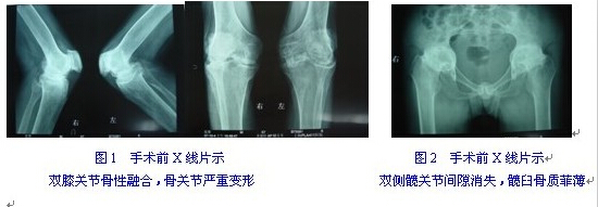 术前.jpg